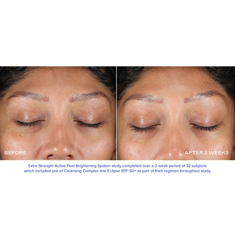 iS Clinical Extra Strength Active Peel Brightening System