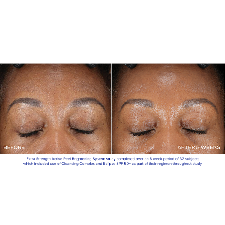 iS Clinical Extra Strength Active Peel Brightening System