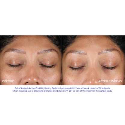 iS Clinical Extra Strength Active Peel Brightening System